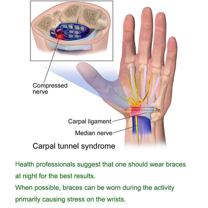 Compression Wrist Band for Carpal Tunnel & Tendonitis Relief