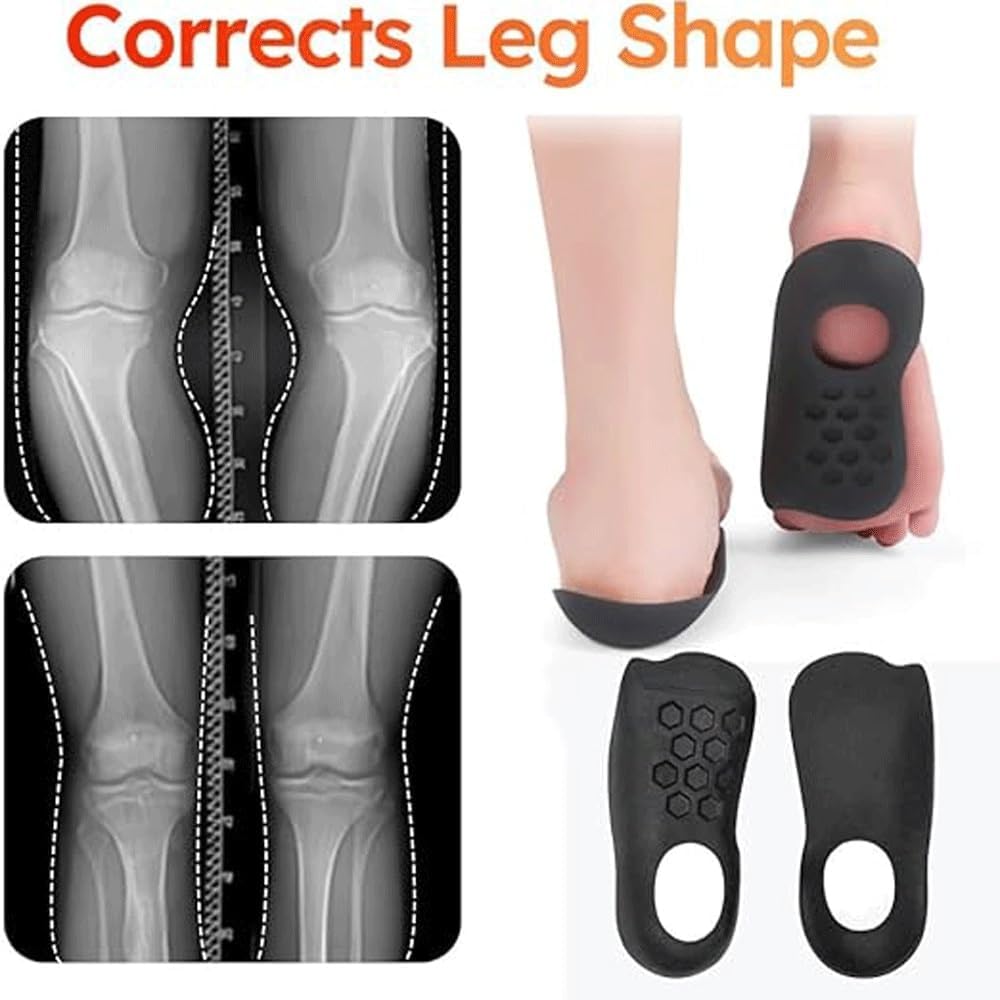 Orthotic Arch Support Insoles for Flat Feet & Plantar Fasciitis