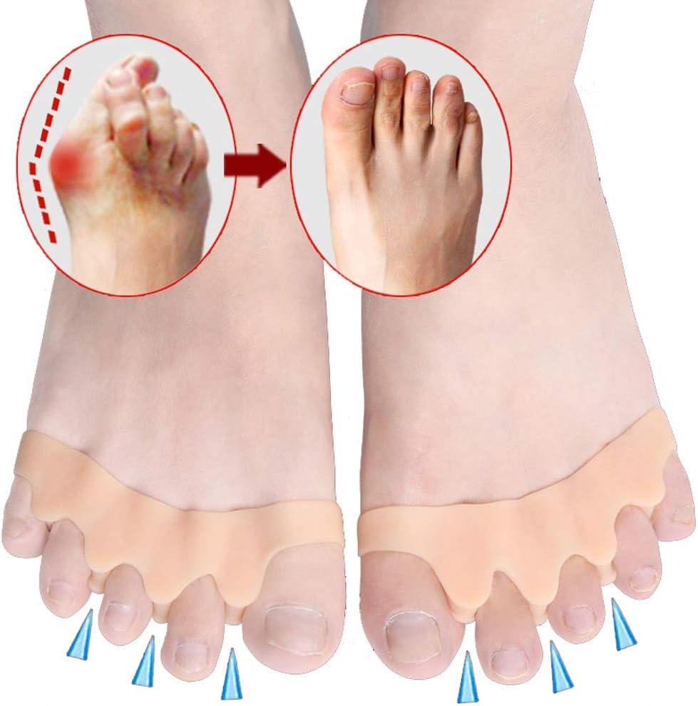 5-Toe Silicone Separator Pads – Orthopedic Bunion Corrector & Overlapping Toe Pain Relief